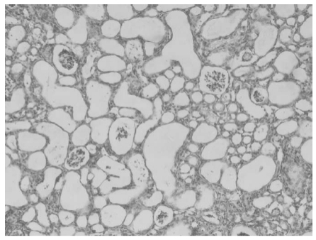 Serieintroduktion til aktive folaturenheder: ① Afsløring af virkningen af ​​5-methyltetrahydropteroic acid.